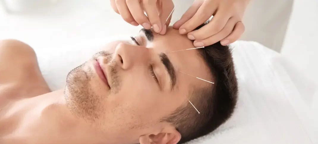 Charlotte Contemporary Neurofunctional Acupuncture