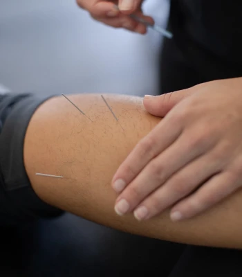 Sports Chiropractic