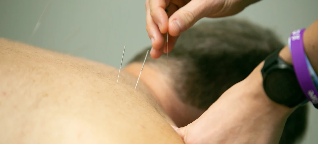 Charlotte Dry Needling