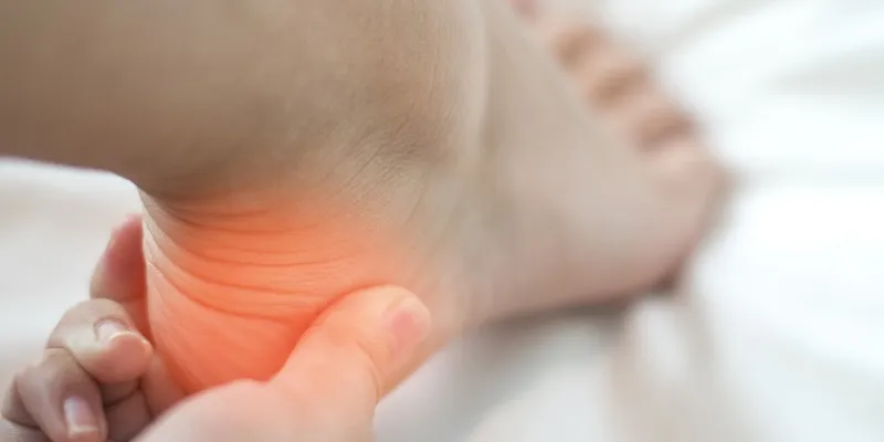Charlotte Sever’s Disease