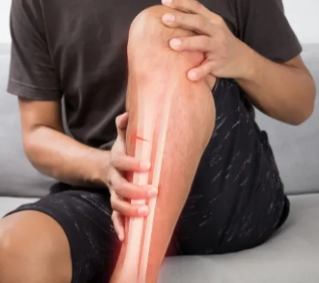 Acupuncture